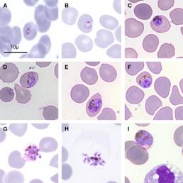 Plasmodium knowlesi, malaria parasite