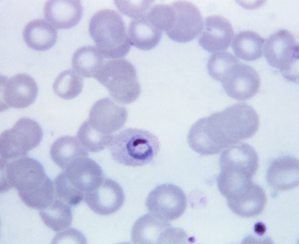 Plasmodium ovale, malaria parasite