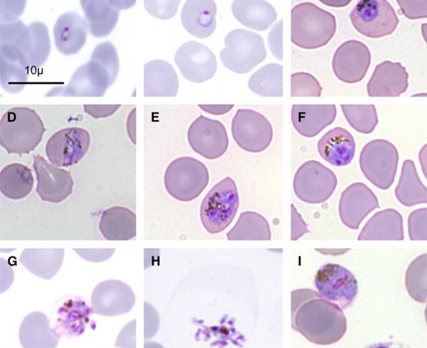 Plasmodium knowlesi, malaria parasite