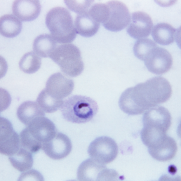 Plasmodium ovale, malaria parasite