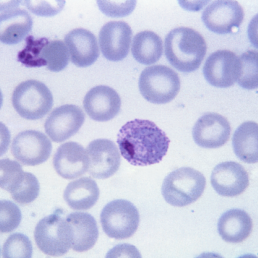 Plasmodium vivax, malaria parasite