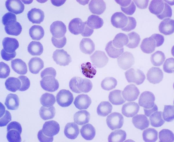 Plasmodium malariae, malaria parasite