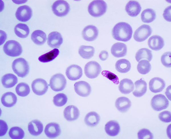 Plasmodium falciparum, malaria parasite