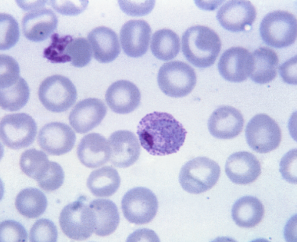 Plasmodium vivax, malaria parasite