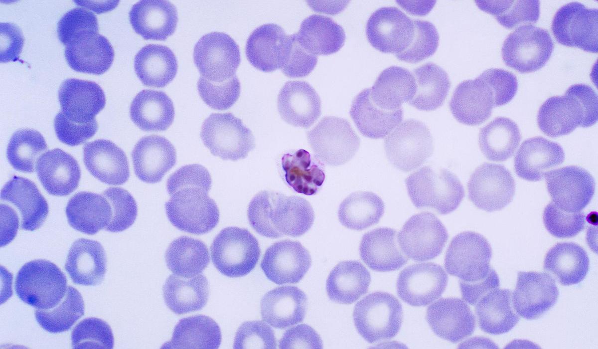 Plasmodium malariae, malaria parasite