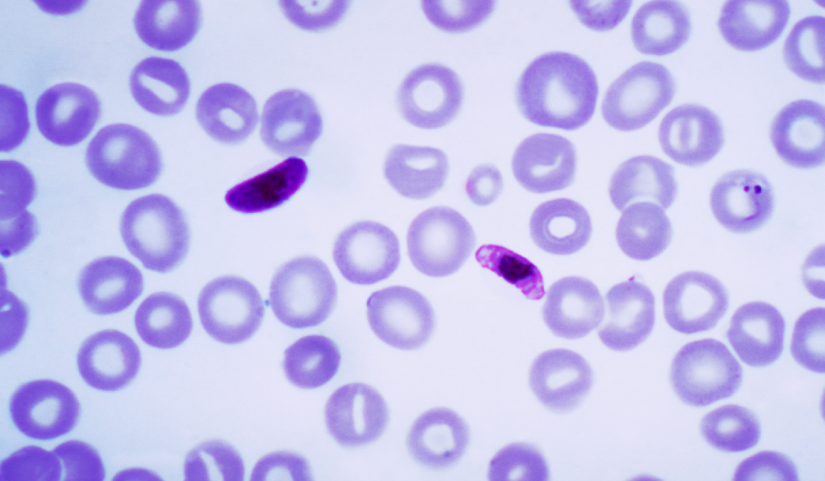 Plasmodium falciparum, malaria parasite