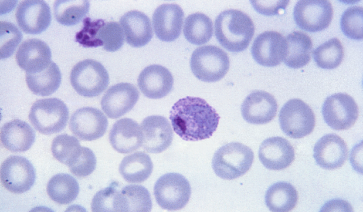 Plasmodium vivax, malaria parasite